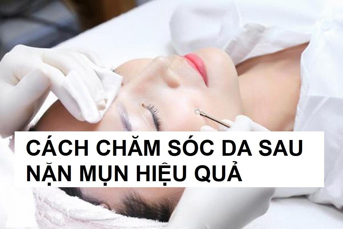 Hướng Dẫn Cách Chăm Sóc Da Sau Nặn Mụn Không để Lại Thâm Sẹo Beaudyvn 