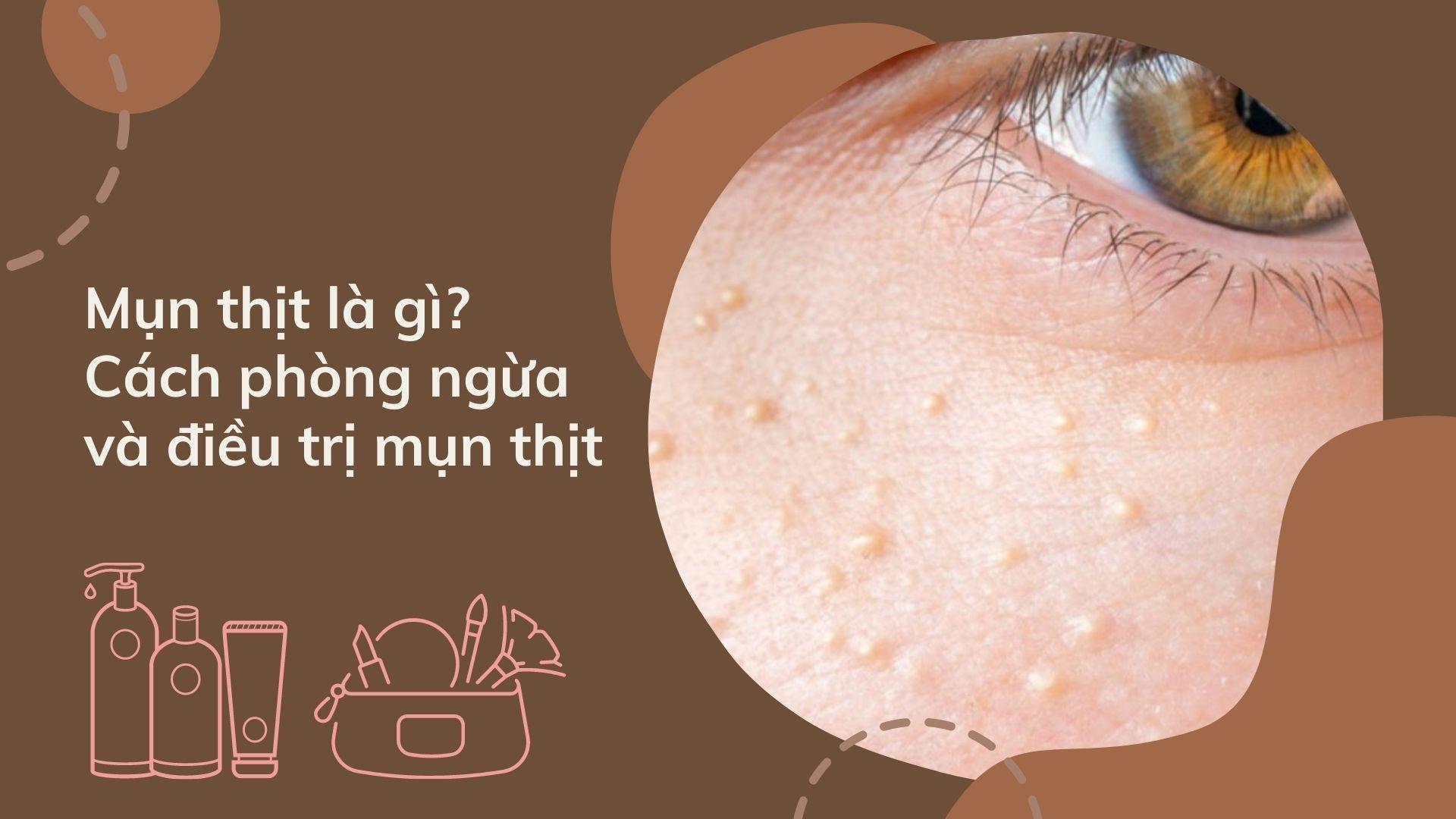 Mụn thịt là gì? Nguyên nhân, điều trị và cách phòng ngừa mụn thịt ...